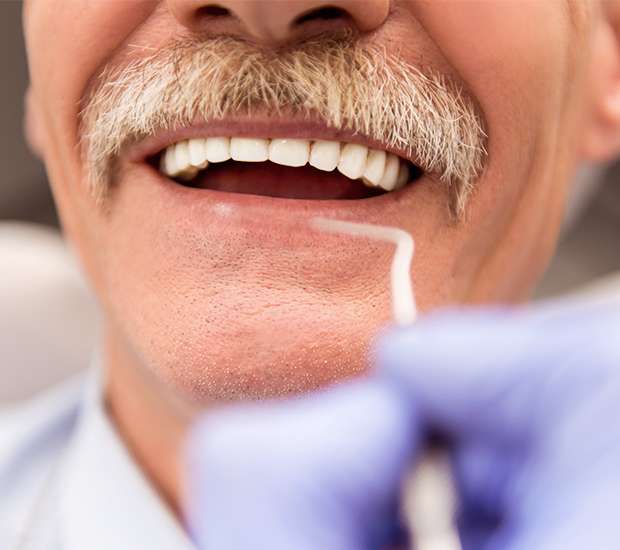Stockbridge Adjusting to New Dentures