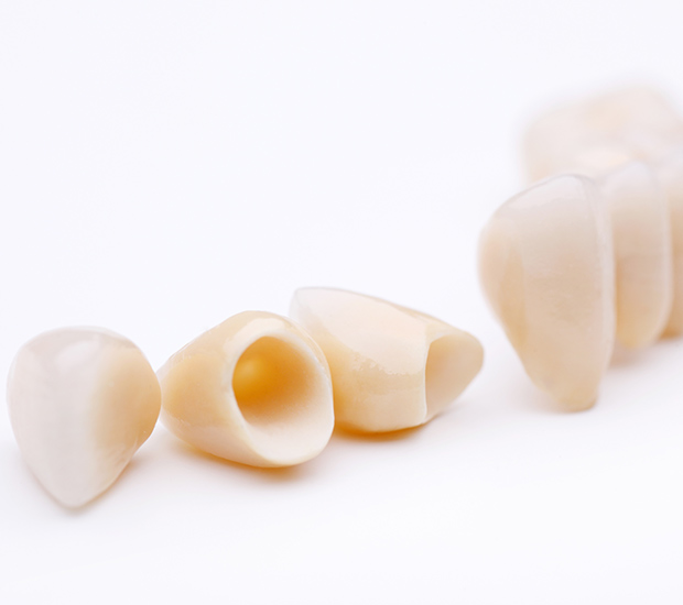 Stockbridge Dental Crowns and Dental Bridges