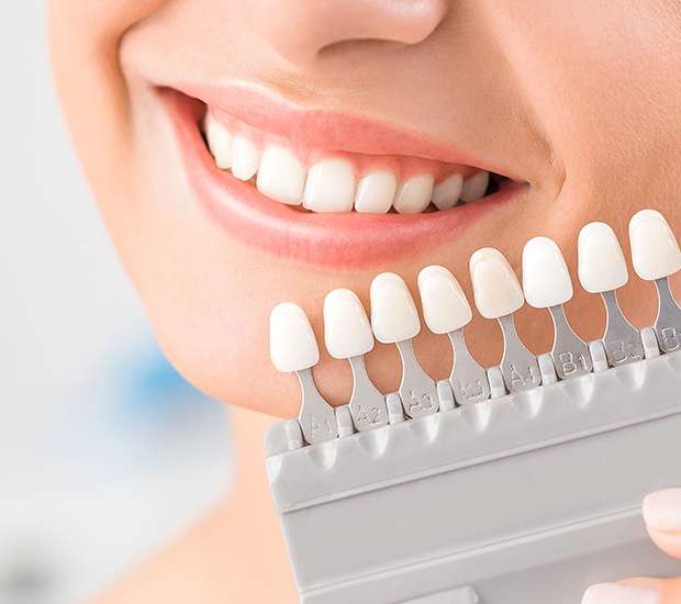 Stockbridge Dental Veneers and Dental Laminates