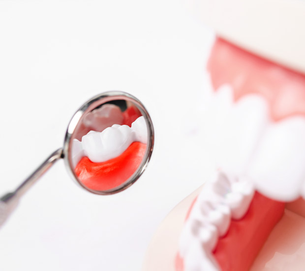 Stockbridge Periodontal Probing