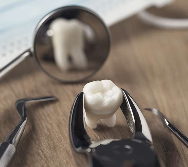 Stockbridge When Is a Tooth Extraction Necessary